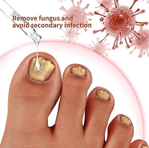 Fungus-Free Nail Revitalizer