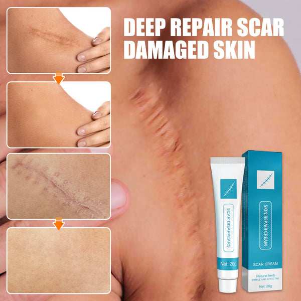 Smooth Skin Solution Cream