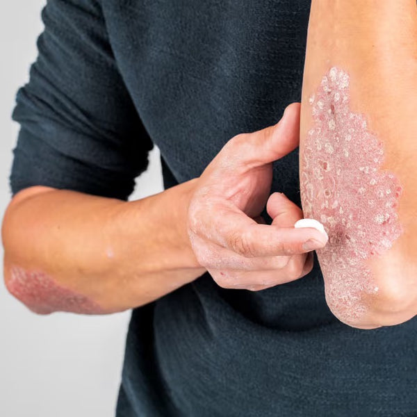 Kräuter-Hautberuhigungs-Salbe